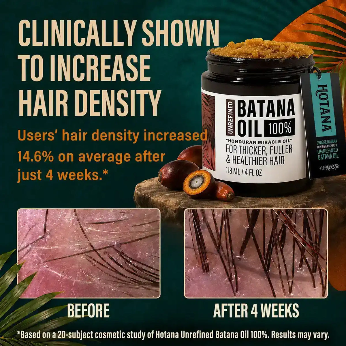 Hotana Unrefined Batana Oil for hair density with before and after results.